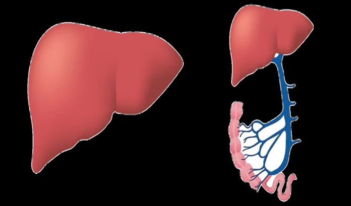fatty liver